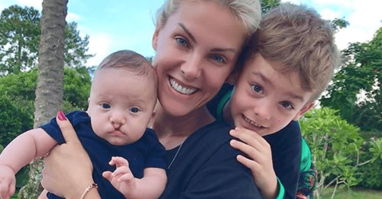 Sobrinho de Ana Hickmann passa por cirurgia e irmã da apresentadora fala sobre o ocorrido: "Continua lindo"