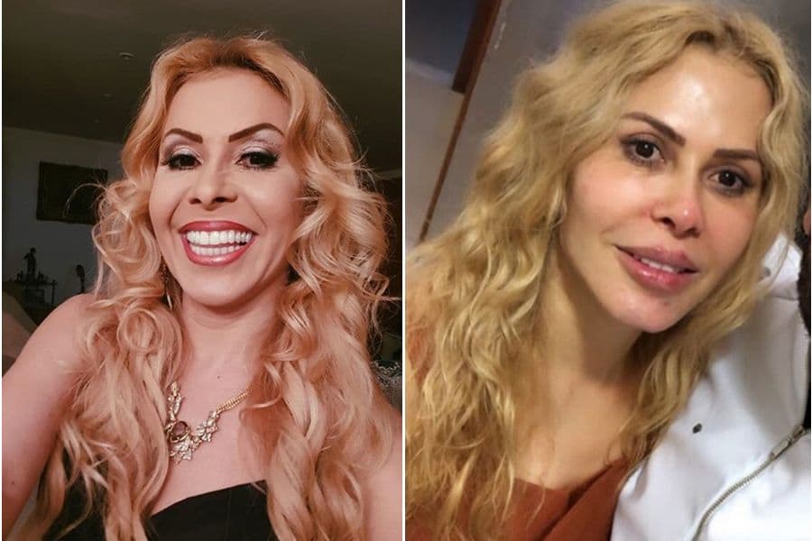 Joelma passou por procedimento de harmonização facial recentemente 