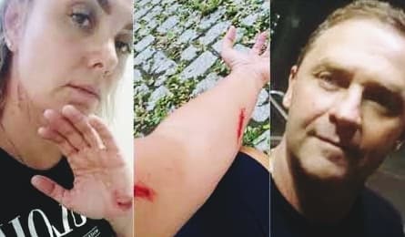 Reviravolta! Após acusar marido de agressão, imagens mostram ex-Paquita cortando seu próprio corpo