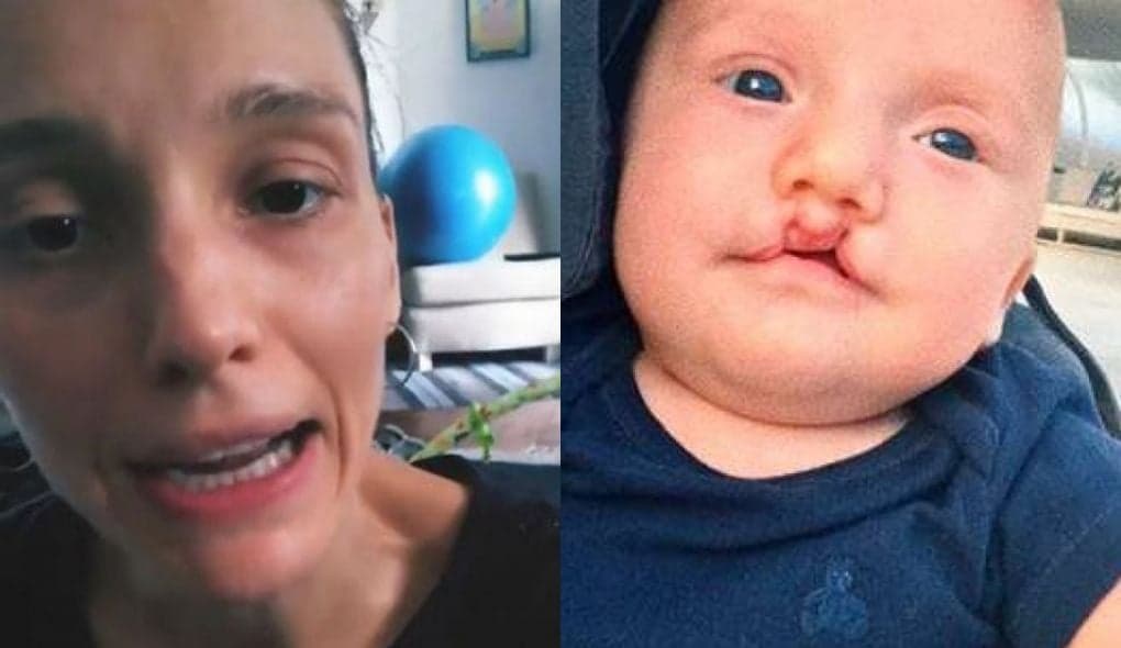 Isabel Hickmann, irmã de Ana Hickmann, faz desabafo após cirurgia do filho: "muito difícil"