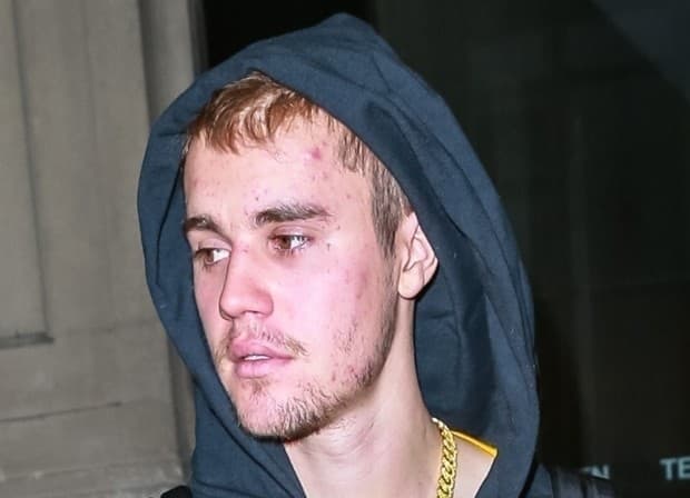 Após revelar grave doença, Justin Bieber manda recado para seus fãs