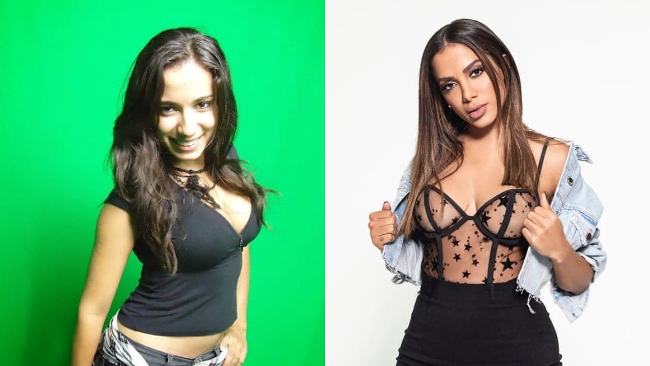 Anitta já fez algumas cirurgias plásticas no passado (Foto: Reprodução) Anitta já fez algumas cirurgias plásticas no passado (Foto: Reprodução)