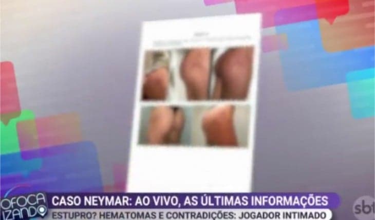 "Suposta "Suposta