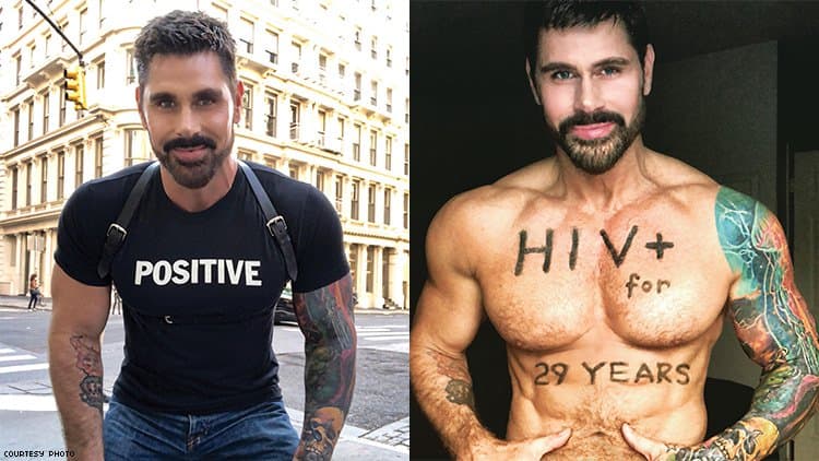 Veja 9 famosos que vivem com HIV e você provavelmente não sabia