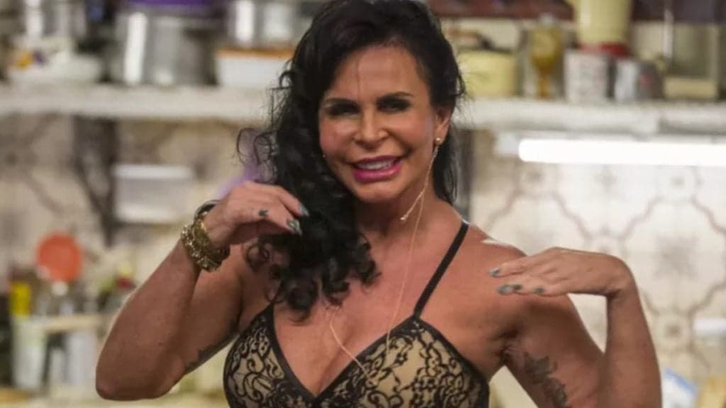 Gretchen passa por grande cirurgia, rosto é afetado e famosa surge completamente diferente