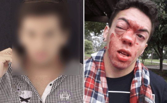 Famoso ator é brutalmente espancado na rua e fica com o rosto irreconhecível
