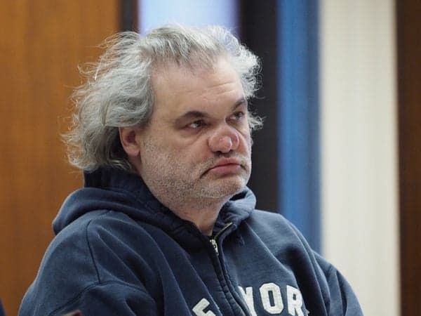 Artie Lange fica totalmente sem nariz após polêmica com drogas (Foto: Reprodução) Artie Lange fica totalmente sem nariz após polêmica com drogas (Foto: Reprodução)