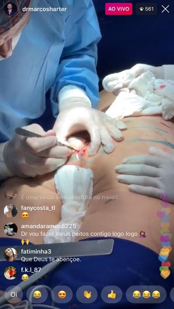Marcos Härter fez transmissão ao vivo (Foto: Reprodução/Instagram) Marcos Härter fez transmissão ao vivo (Foto: Reprodução/Instagram)