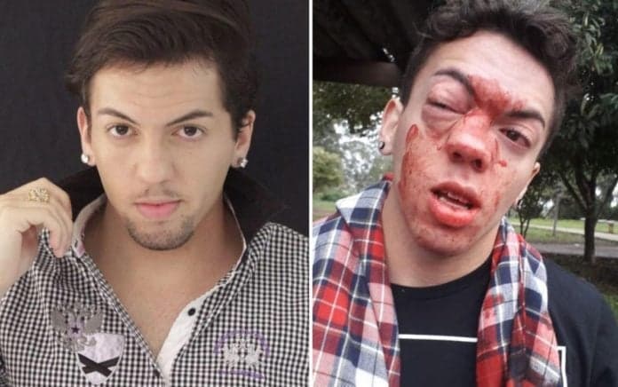 O ator Marcello Santana (Reprodução) gay