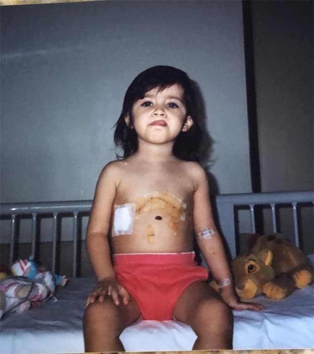 Jéssica Costa mostrou foto da infância após realizar cirurgia cardíaca (Foto: Reprodução/Instagram) Jéssica Costa mostrou foto da infância após realizar cirurgia cardíaca (Foto: Reprodução/Instagram)