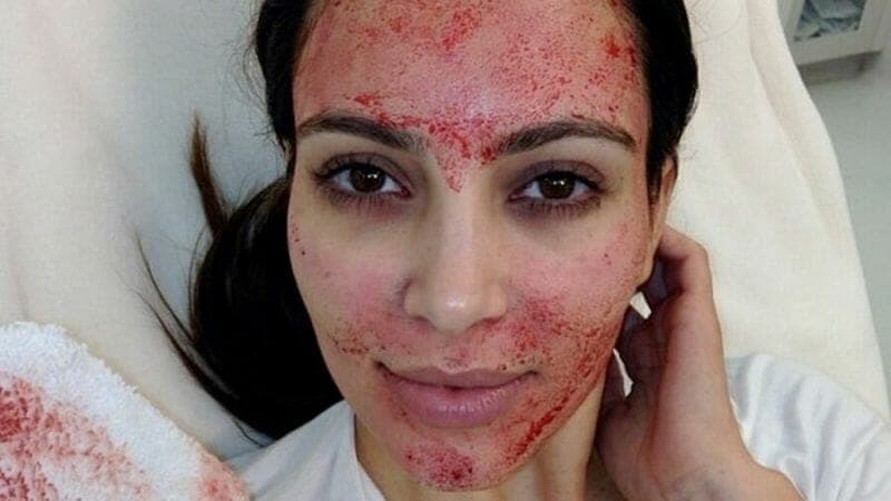 Kim Kardashian abre processo judicial contra médico após tratamento facial e uso de sua imagem sem permissão