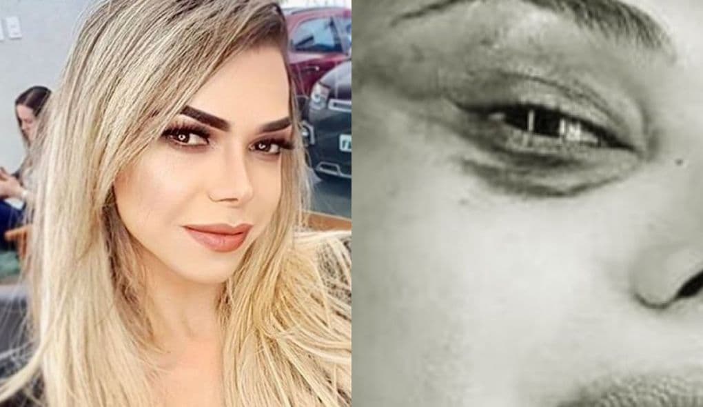 Léo Áquilla surge com o rosto "deformado" e deixa público em estado de choque: "Jesus amado!"