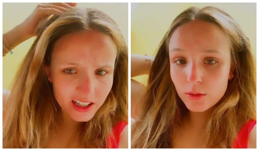 Larissa Manoela se queima, expõe foto assustadora da região atingida e preocupa público