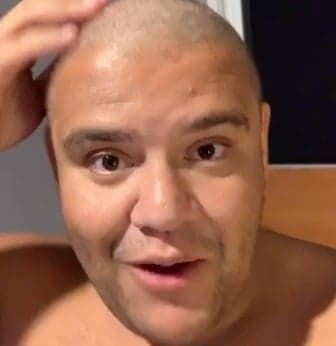 Gominho aparece careca, faz desabafo comovente e choca público ao explicar motivo da mudança