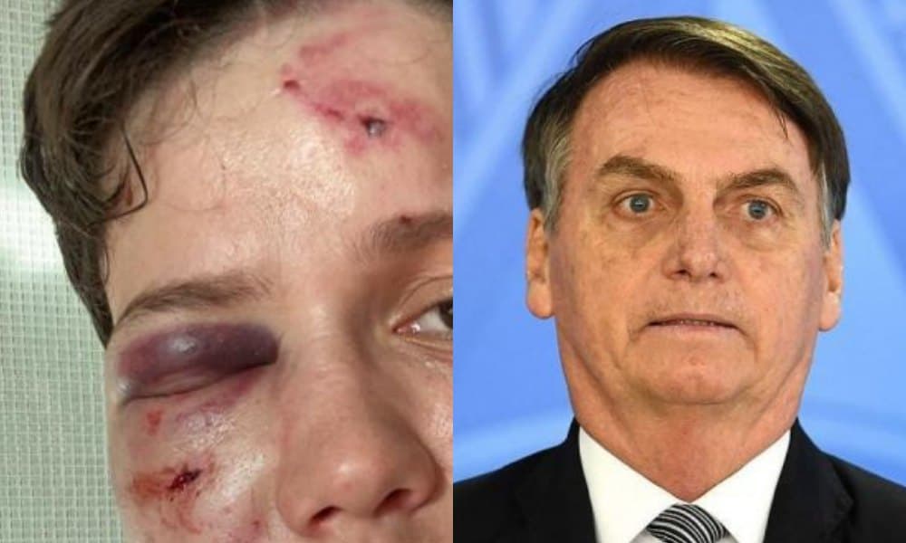 Famosa amiga íntima da família Bolsonaro é brutalmente espancada por ser homossexual
