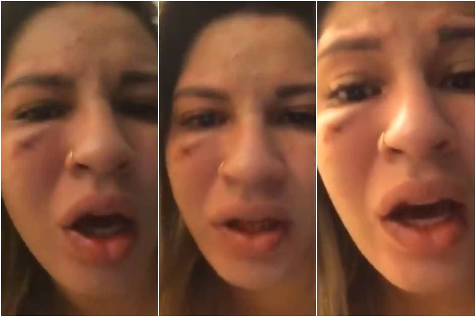 Mulher de famoso é brutalmente atacada pelo marido e revela detalhes chocantes: 'Já veio me enforcando'