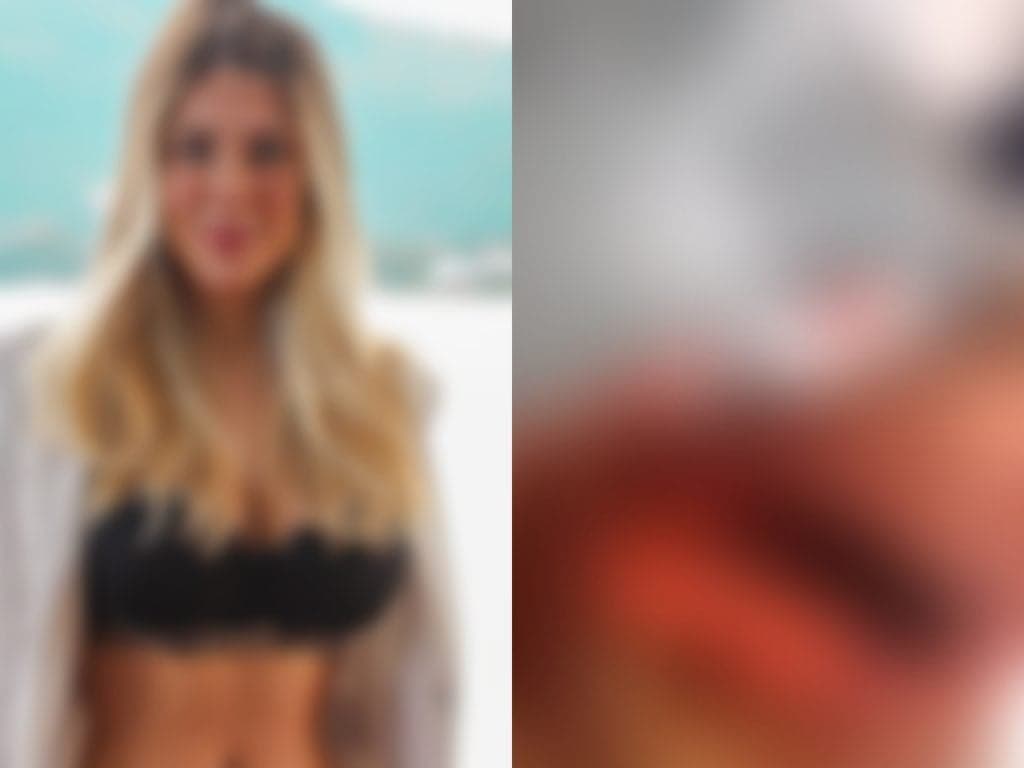 Famosa é atacada brutalmente por animal feroz e precisa ser socorrida às presas: "Arrancou um pedaço do meu braço"