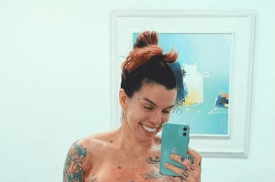 Penélope Nova choca ao aparecer com seios de fora para mostrar resultado do silicone; veja