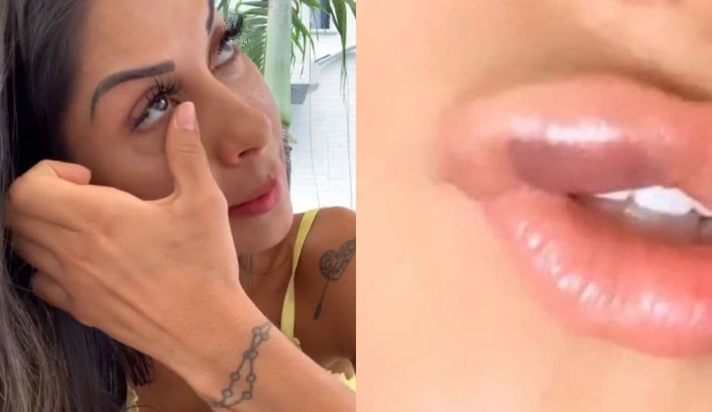 Mayra Cardi fica com boca machucada após se envolver em acidente com a filha