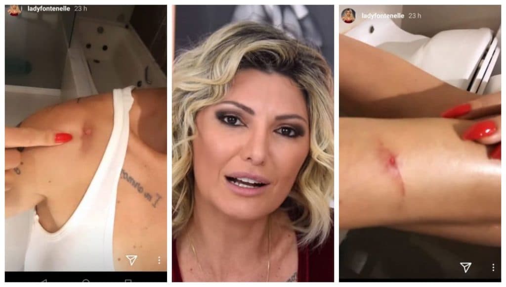 Antônia Fontenelle expõe machucados em vídeo e reclama de dor após acidente
