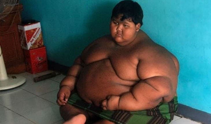 Superação! Garoto mais gordo do mundo consegue feito surpreendente e impressiona com resultados; veja como ele está atualmente