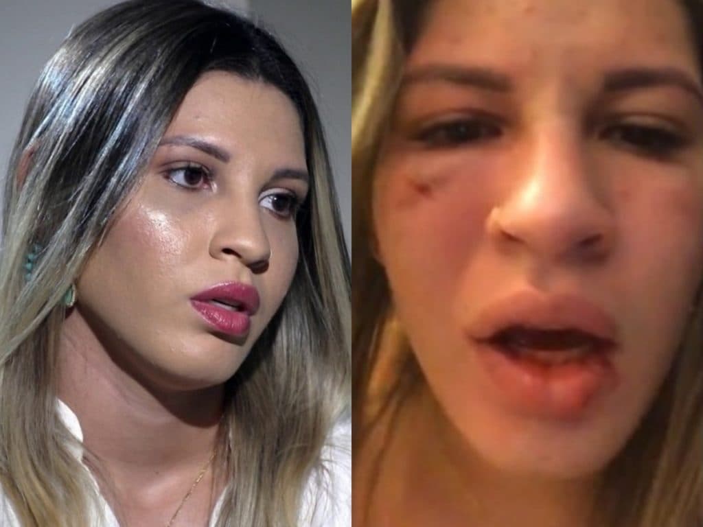 Após ser espancada pelo famoso goleiro do São Paulo, Milena expõe traição e dispara: "Continua me perseguindo"