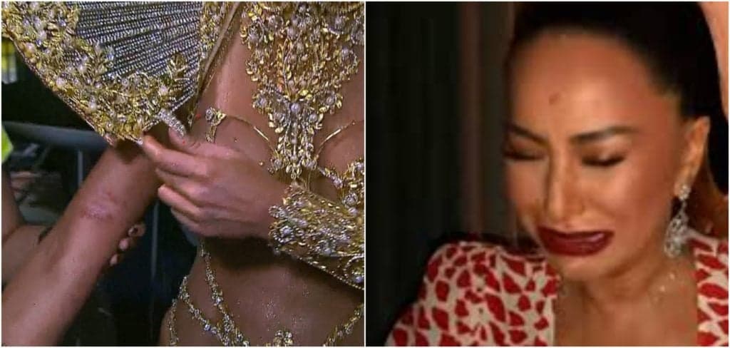 Sabrina Sato sofre 'acidente' durante desfile no carnaval, fica ensaguentada e desabafa: 'Toda machucada'
