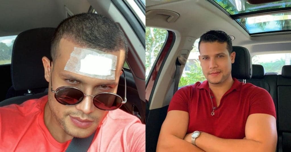 Israel Novaes se machuca durante quarentena e faz alerta: "cuidado"