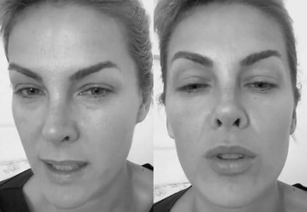Ana Hickmann se irrita após ser alvo de notícia, nega situação e dispara: "Isso é um absurdo''