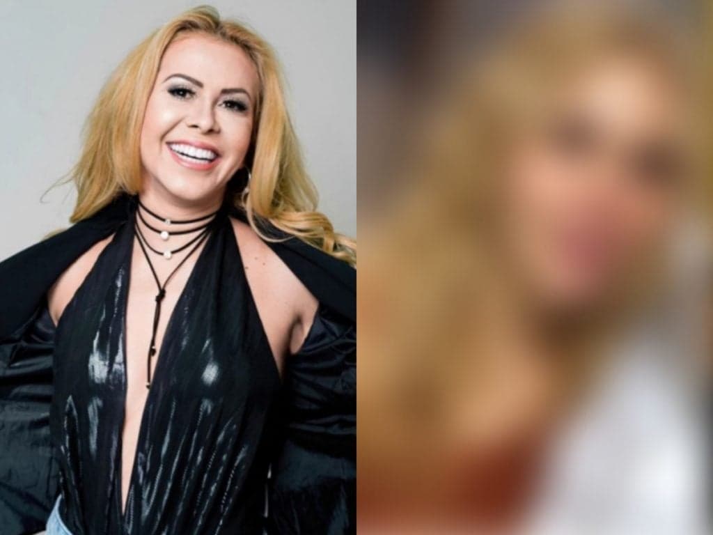 Chocada! Joelma espanta ao aparecer irreconhecível após passar por mais de 5 cirurgias plásticas: "Meu Deus"