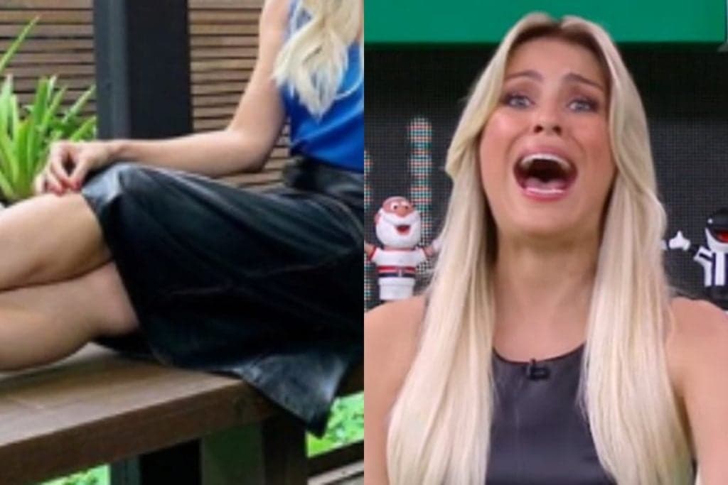 De saia, Renata Fan exibe pernões malhados e detalhe surpreendente chama atenção: "O que é isso?"