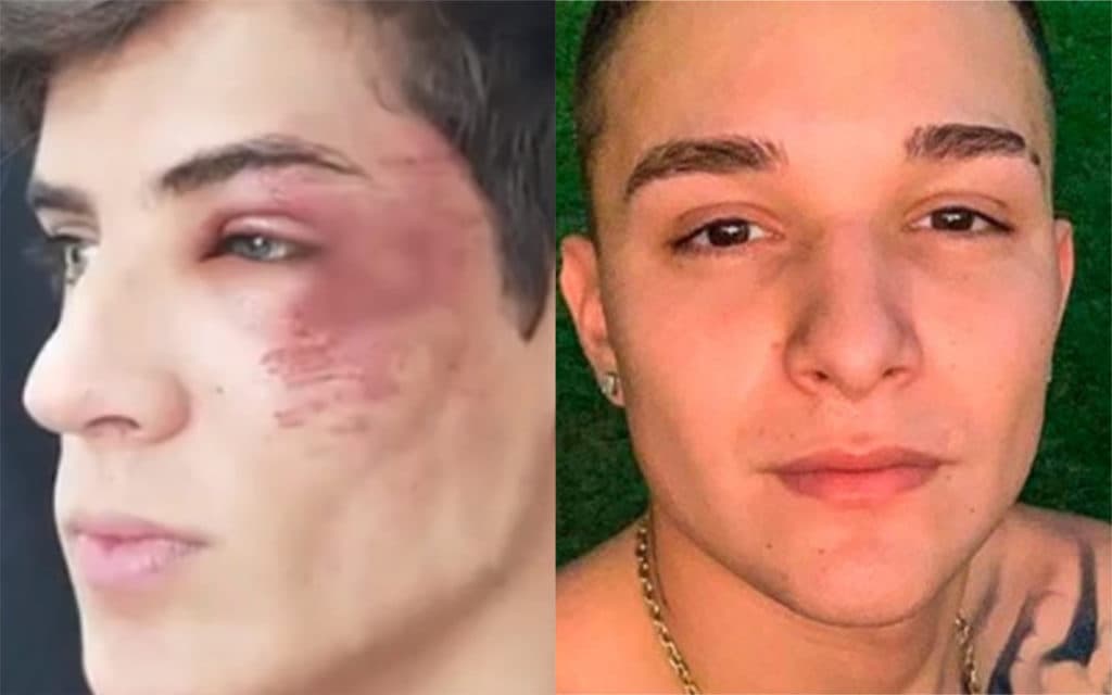 Tiago Ramos, padrasto de Neymar, se envolve em suposta briga com MC Gui e fica com o rosto deformado