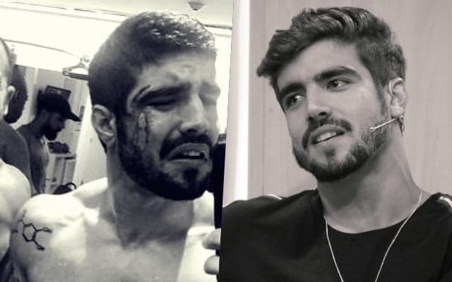 Ao vivo, Caio Castro faz duras críticas e fala sobre 'overdose' na Globo: "Que vergonha"