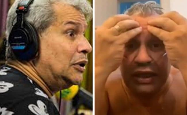 Sikêra Jr tem vídeo respirando com ajuda de aparelhos divulgado e cena agonizante preocupa: "Meu Deus"
