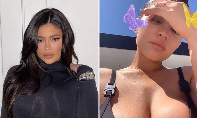 Sem photoshop, Kylie Jenner expõe marcas no corpo e desabafa: "apenas aceitei"