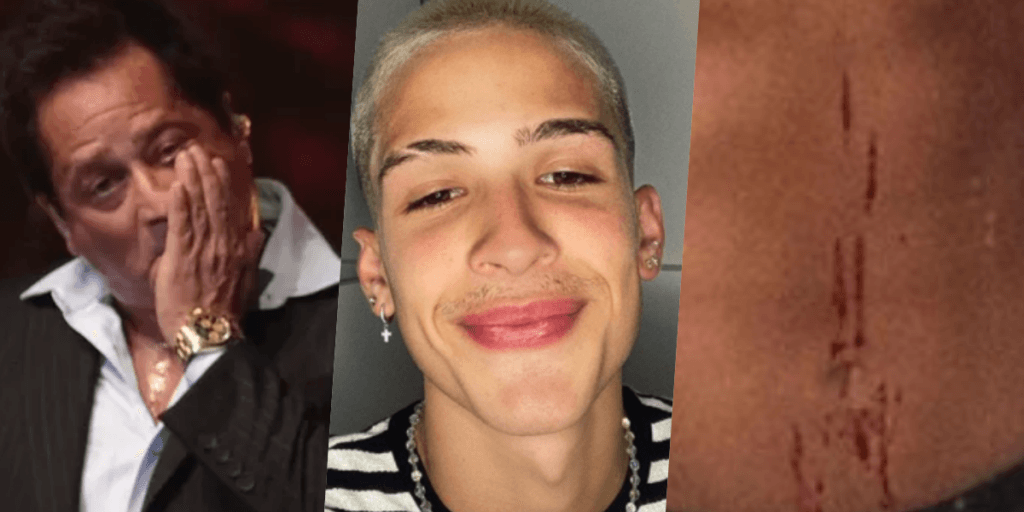 João Guilherme, filho de Leonardo, surge em foto ensanguentado e assusta fãs