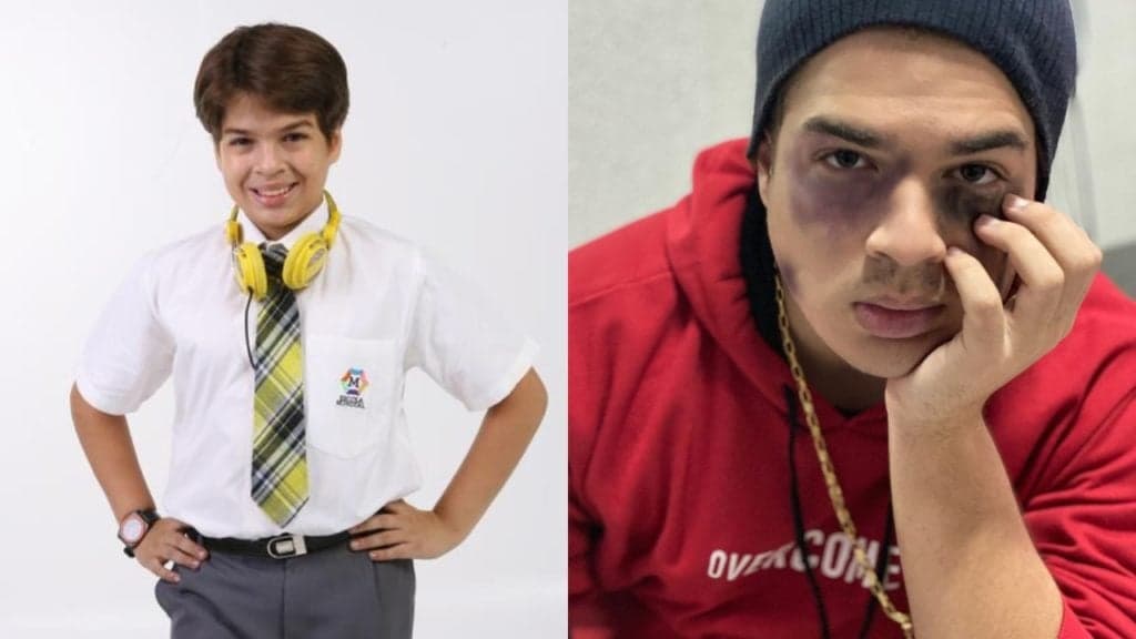 Ator de Carrossel, após rasgar o verbo sobre homossexualidade, surge com rosto todo roxo: "Vamos falar"