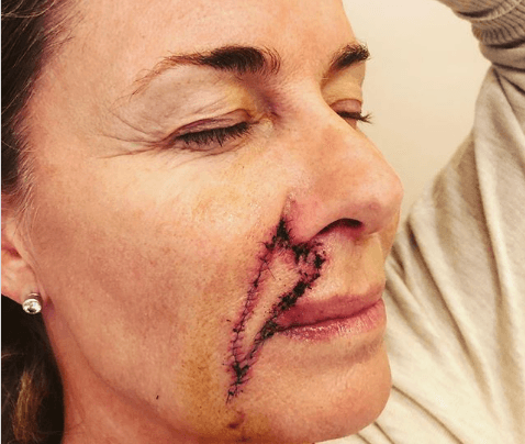Diagnosticada com câncer, apresentadora faz desabafo e revela gravidade: "tarde demais”