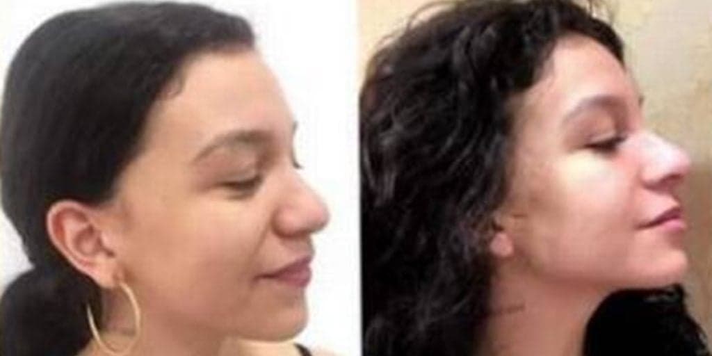 Cantora Priscilla Alcântara exibindo o seu antes e depois (Foto: Montagem)