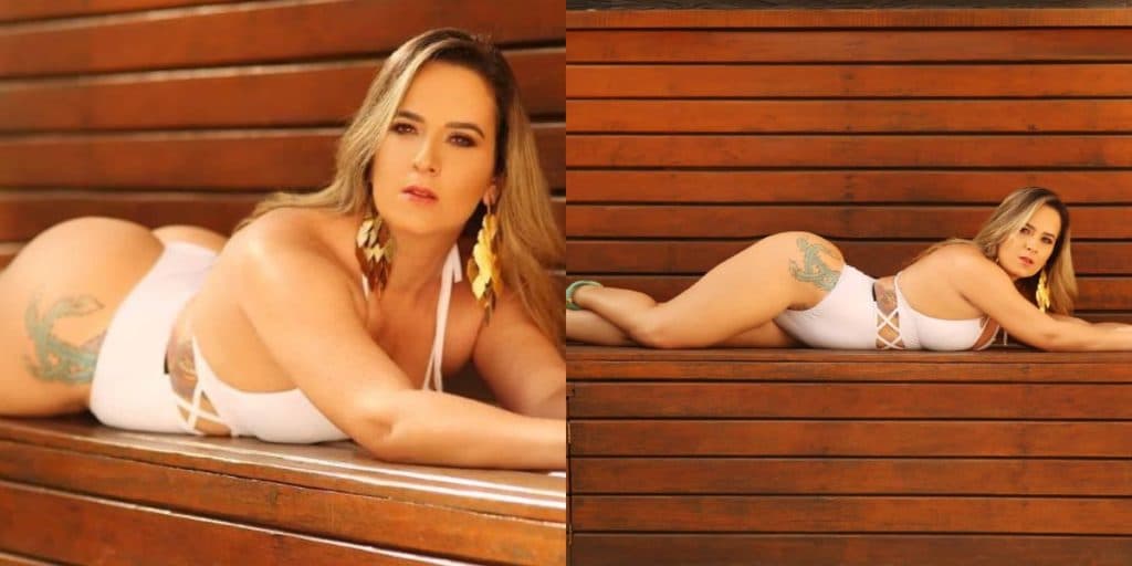 Modelo participante do Miss Bumbum sofre grave acidente de moto e perde braço