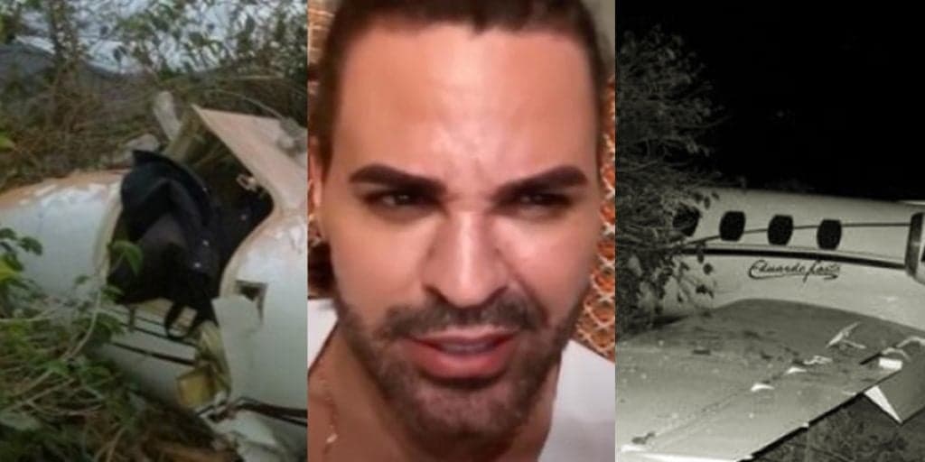 Eduardo Costa escancara acidente de avião, rosto desfigurado com nariz afundado e confessa: "Osso da cabeça trincou"