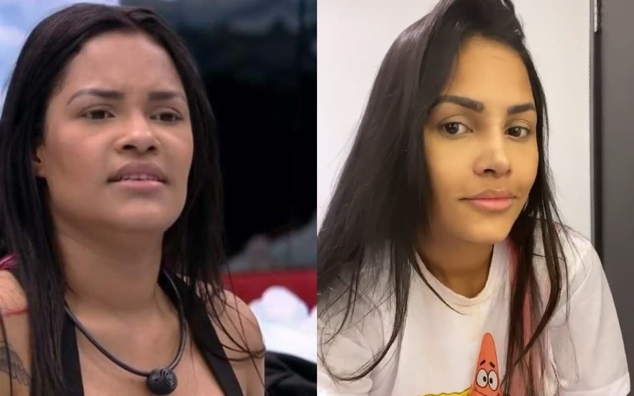Antes e depois da rinoplastia e harmonização facial de Flayslane (Foto: reprodução)