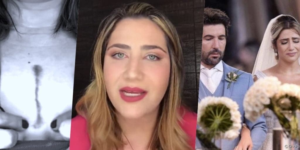 Jessica Costa, filha de Leonardo, aparece em vídeo, expõe corte no peito e fala sobre ex-marido