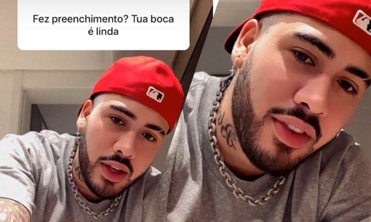Kevinho disse que sua boca carnuda não é procedimento estético,  "é natural! (Montagem: TV Foco)