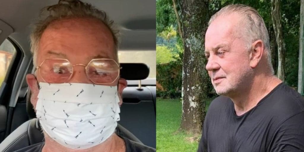 Luiz Fernando Guimarães sofre acidente, passa por cirurgia e faz vídeo desabafando: "Plantão e mascarado"