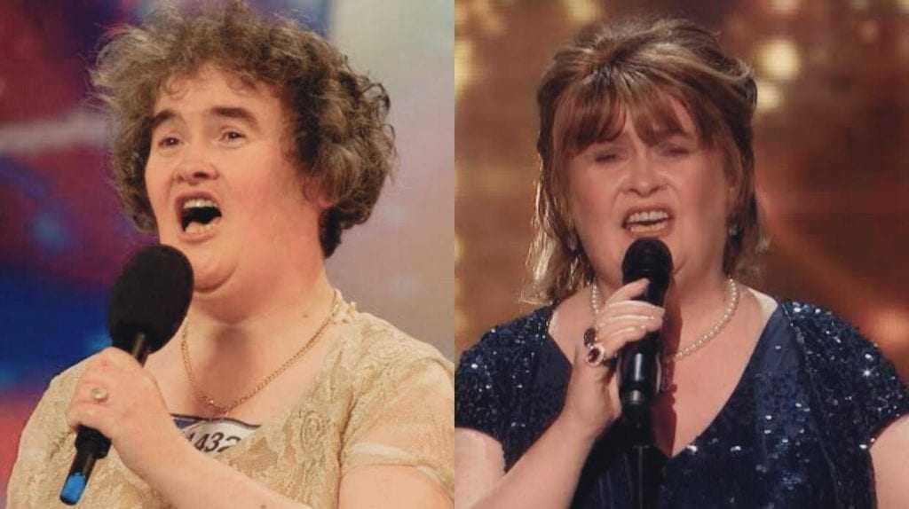 Susan Boyle, 11 anos após conquistar o mundo, espanta, passa por transformação e surge irreconhecível