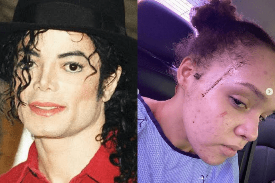 Sobrinha de Michael Jackson leva sete facadas, é vítima de ataque racista e dispara: "sou preta"