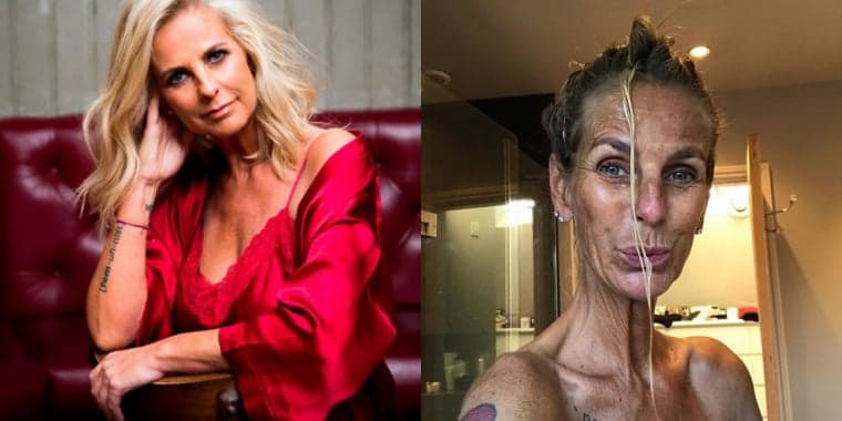 Apresentadora revela vício em tomar banho de sol, surge com aparência 'acabada' e espanta: "horrível"