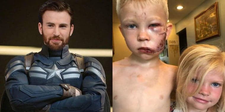 Chris Evans, o Capitão América, manda mensagem para garoto que levou 90 pontos no rosto após salvar irmã: "Herói"