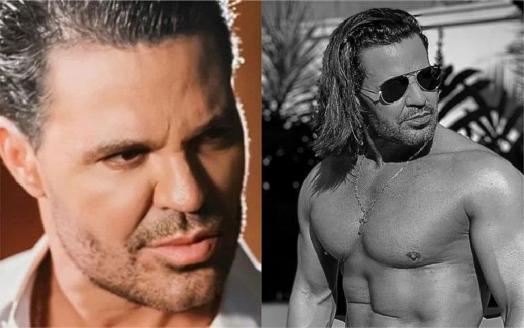 Maldição de pastor, rosto desfigurado em acidente e farsa escrachada: Eduardo Costa tem vida chutada ao Brasil